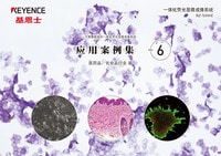 BZ-X 系列 不需要暗室的一體化熒光顯微成像系統(tǒng) 應(yīng)用案例集 Vol.6